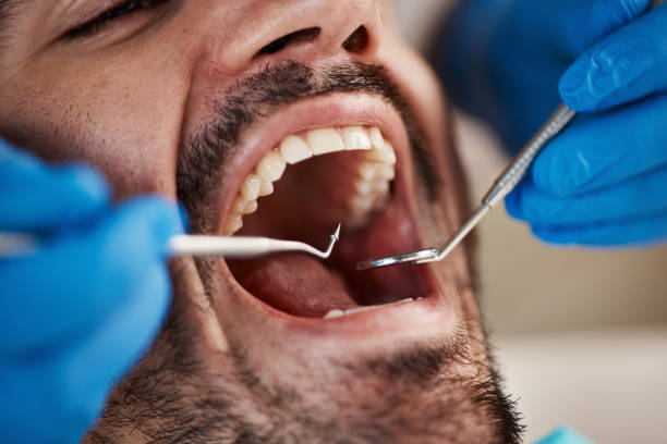 Best Urgent Care for Lost Fillings or Crowns in Tucson Mountains, AZ