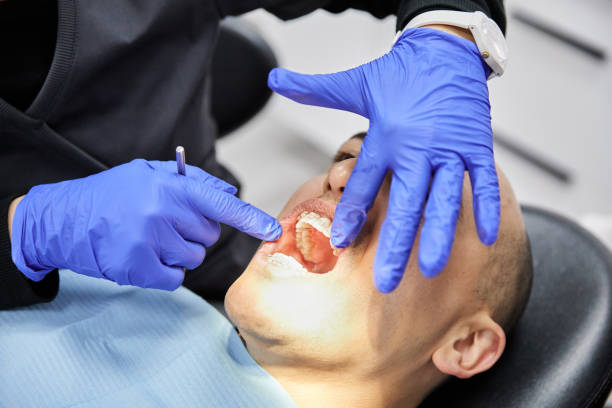 Best Emergency Dental Care for Broken or Chipped Teeth in Tucson Mountains, AZ
